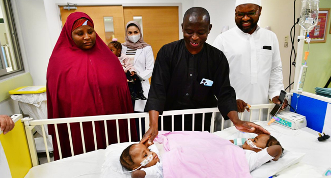 Nigerian Conjoined Twins Successfully Separated