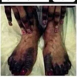 Bleaching 